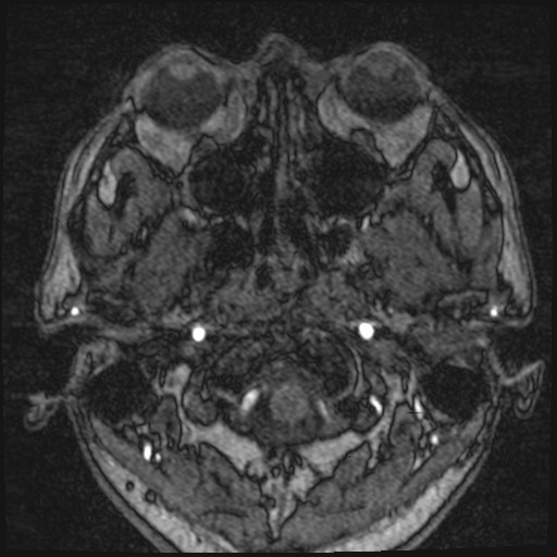 Click on the Serie image to view the images of VILLANUEVA, WILLIAM A.